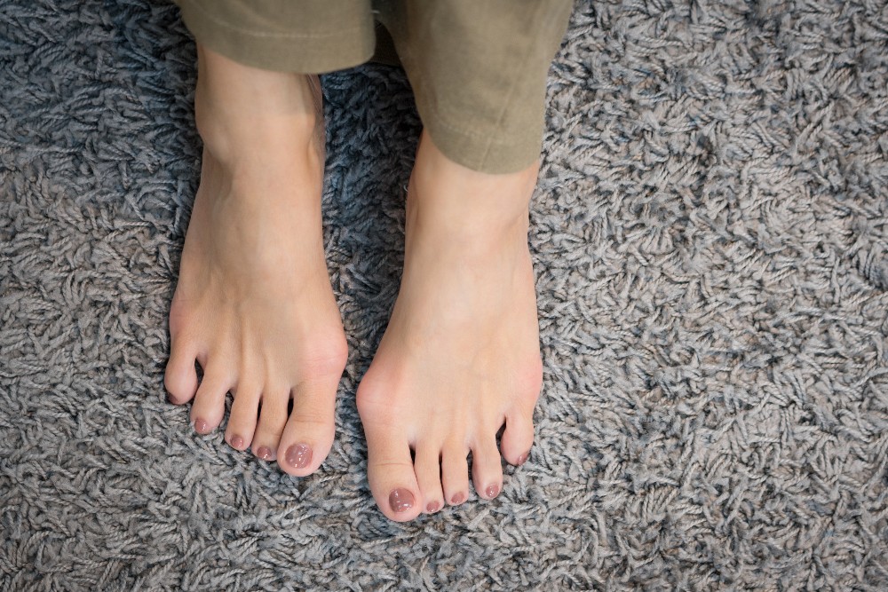 Help! My Teenager Is Getting a Bunion. What Can I Do?