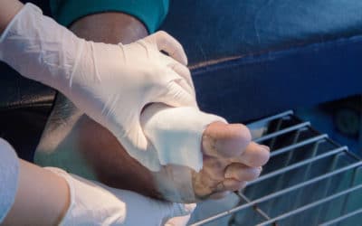 Comprehensive Wound Care Means More than Cleaning and Dressing